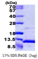 Human CXCL7 / PPBP Protein (Recombinant)