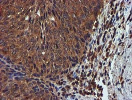 Complement C1s Antibody (clone OTI5F2)