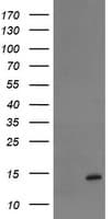 TPRKB Antibody (clone OTI3E3)