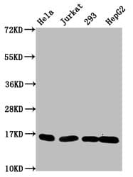 Polyclonal Rabbit anti-Human HIST1H3A Antibody (IHC, WB)