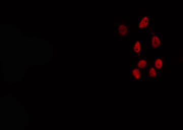 E2F2 Antibody