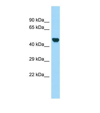 LOC304396 Antibody (aa261-310)