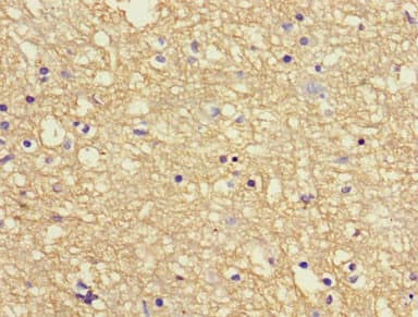 APP / Beta Amyloid Precursor Antibody (aa18-249)