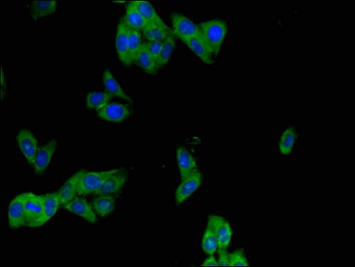 PHLDB2 Antibody