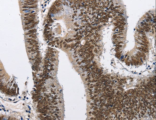 CMTM2 Antibody