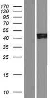 IKBIP Protein (Over-Expression Lysate Myc-DDK (Flag))