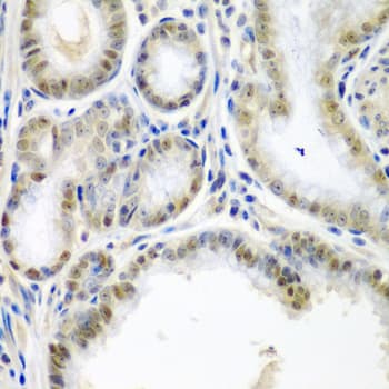 Polyclonal Rabbit anti-Human SSX2 Antibody (IHC, IF, WB)