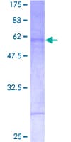 Human MSX2 / MSH Protein (Recombinant GST)