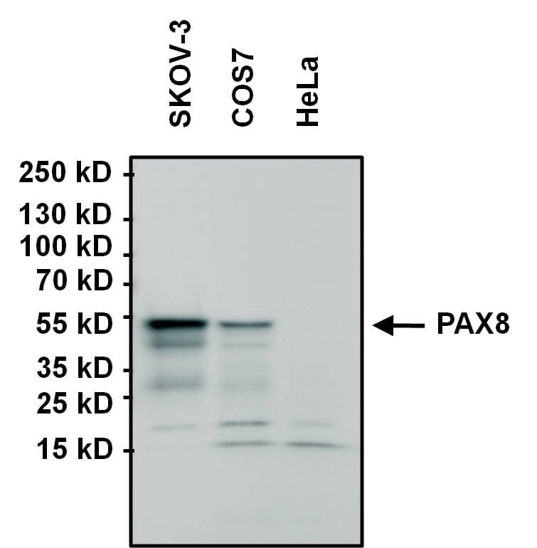 IHC-plus™ Monoclonal Mouse anti-Human PAX8 Antibody (clone 1F8-3A8, IHC, IF, WB)
