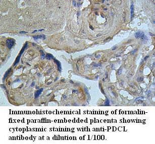 PDCL Antibody (aa25-489)