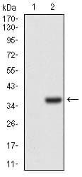 IHC-plus™ IL3RA / CD123 Antibody (aa200-305, clone 10B8E7)
