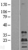 CD9 Protein (Over-Expression Lysate Myc-DDK (Flag))