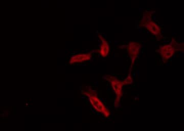 FAK / Focal Adhesion Kinase Antibody (phospho-Tyr397)