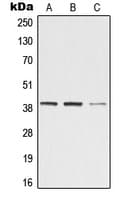 Polyclonal Rabbit anti-Human ZADH2 Antibody (Internal, IHC, WB)