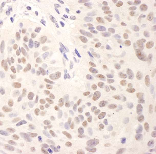 BMI1 / PCGF4 Antibody (aa276-326)