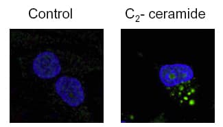 IHC-plus™ MAP1LC3B / LC3B Antibody (N-Terminus)