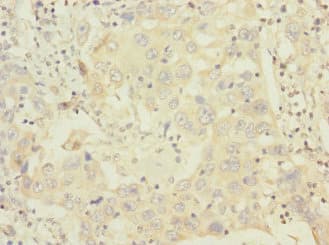 HCFC1R1 / HPIP Antibody
