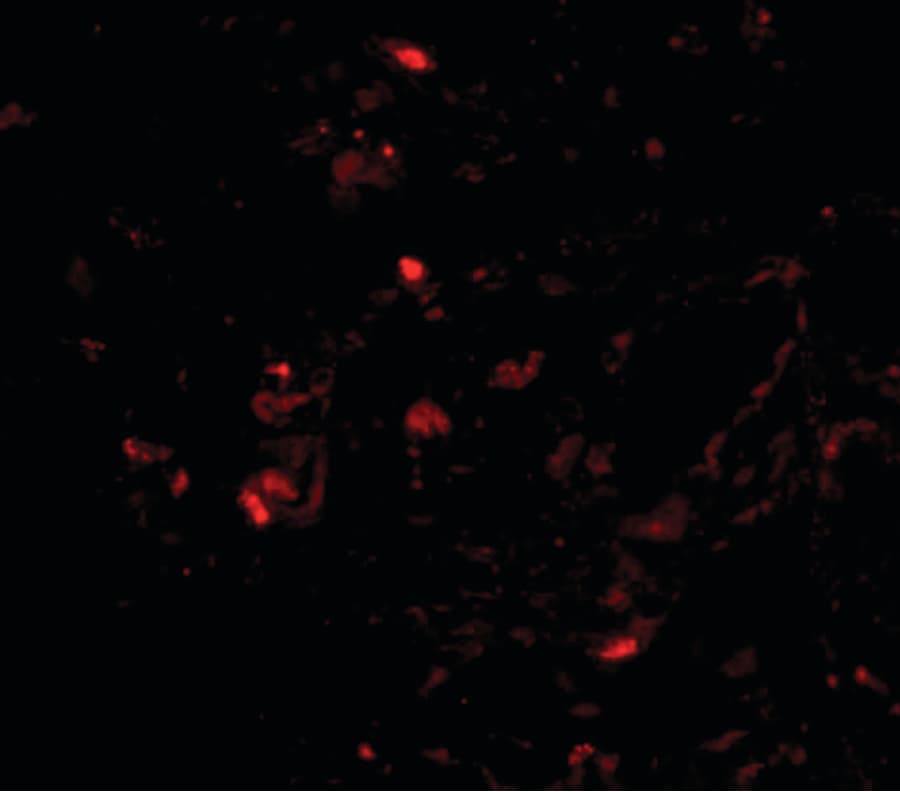 IHC-plus™ TTR / Transthyretin Antibody