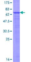 Human EDA2R / XEDAR Protein (Recombinant GST)