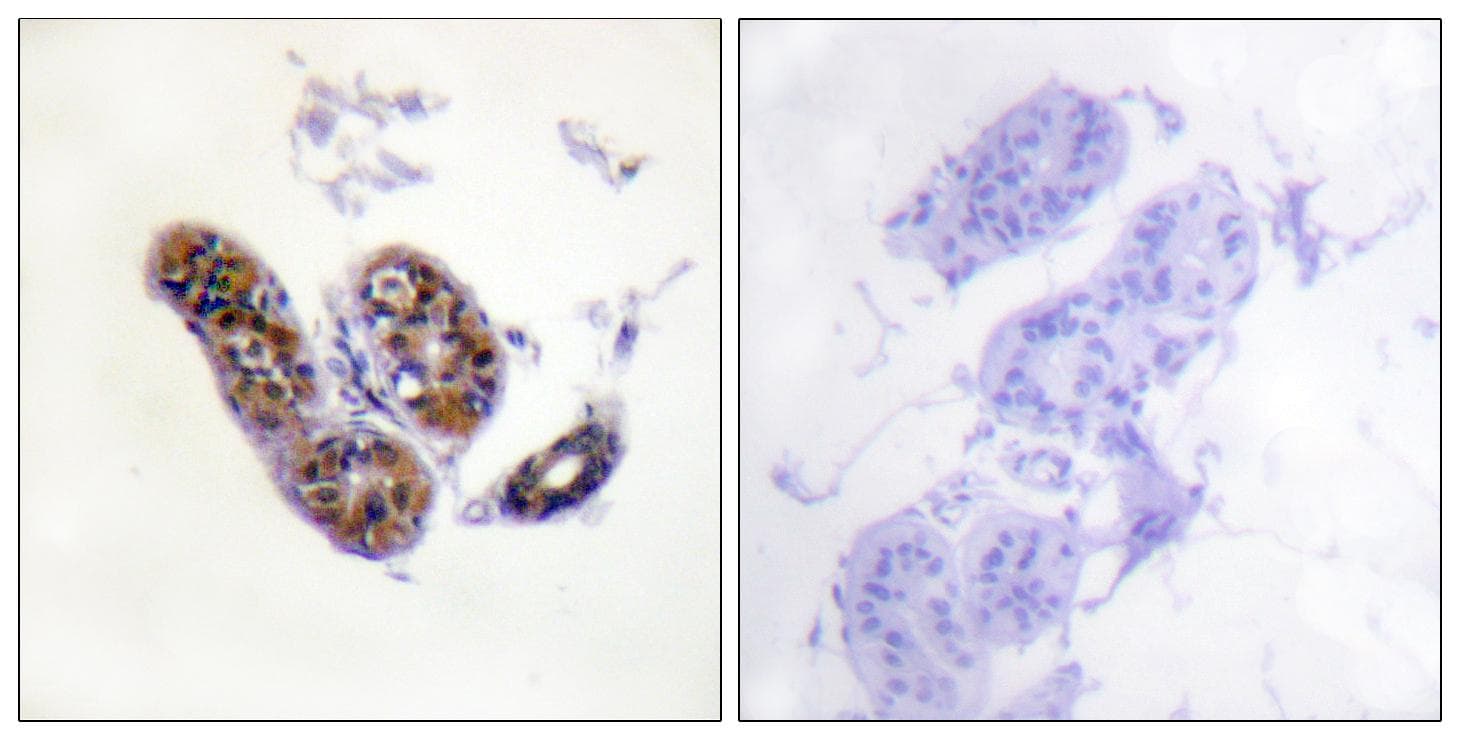 MITF Antibody (p180/73)