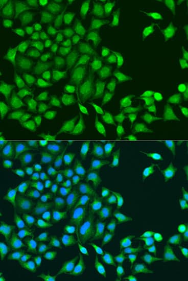 TIP49 / RUVBL1 Antibody