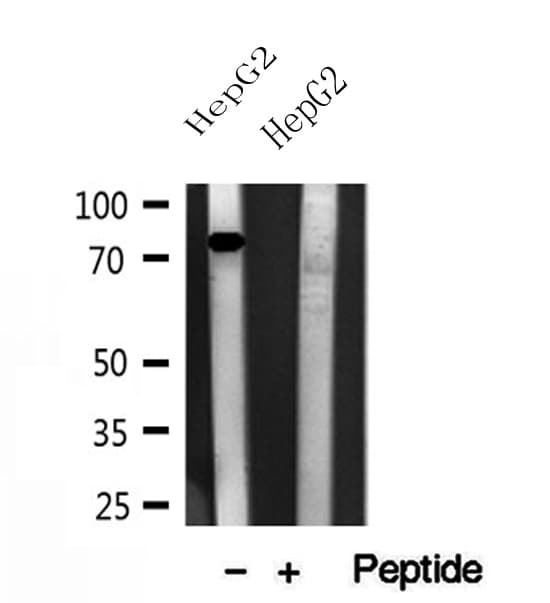 CPT1A Antibody