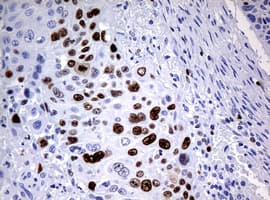 Monoclonal Mouse anti-Human MKI67 / Ki67 Antibody (clone OTI3B6, IHC)