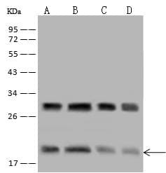 EIF5A2 Antibody (Preservative Free)