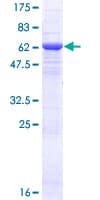 Human CCDC132 Protein (Recombinant GST)