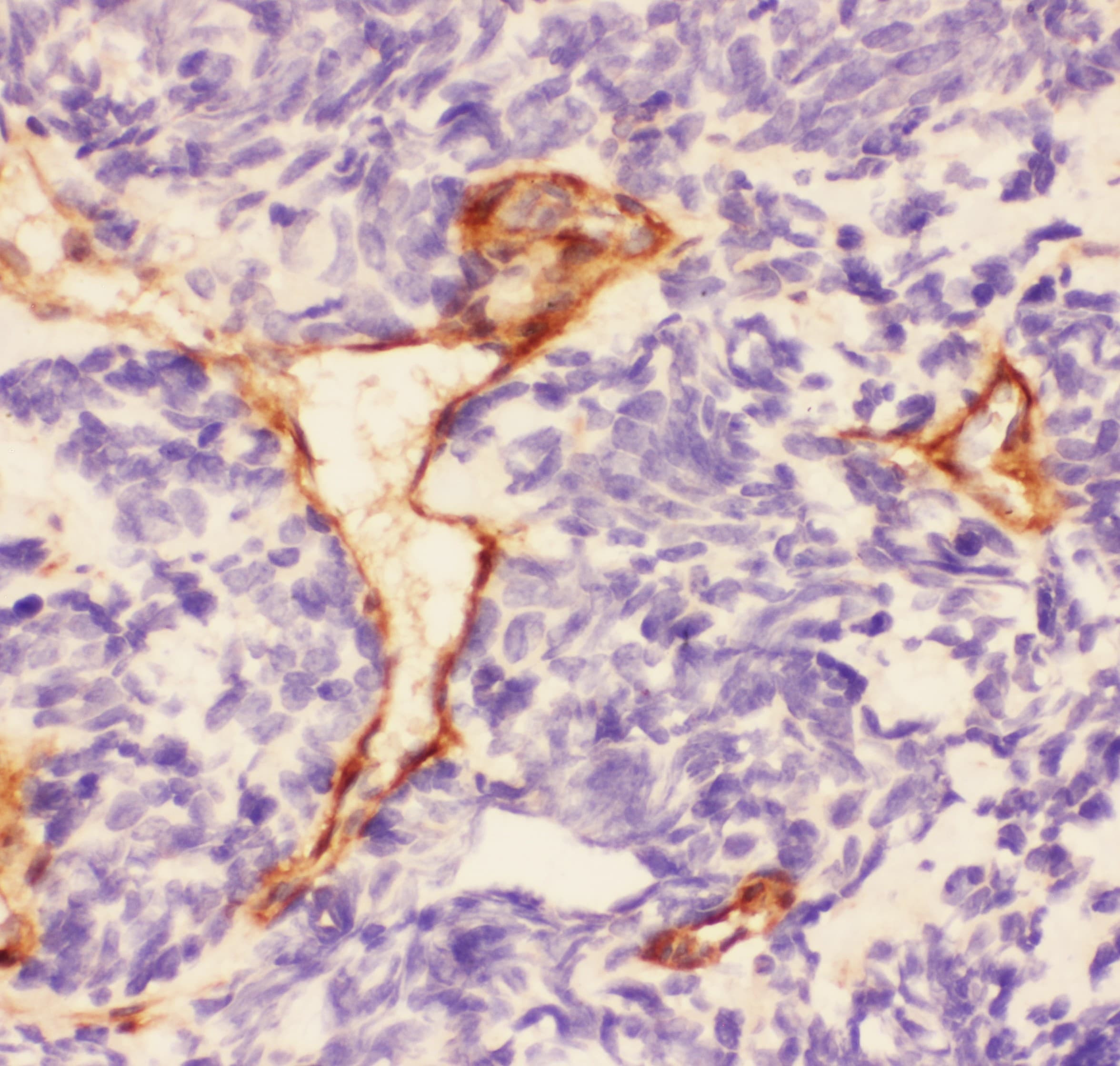 Polyclonal Rabbit anti-Human LAMC1 / Laminin Gamma 1 Antibody (IHC, WB)