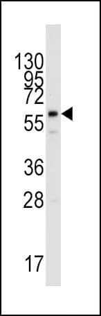 PPAT Antibody (aa175-205)