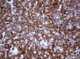 PIK3C2A Antibody (aa230-560, clone OTI4H9)