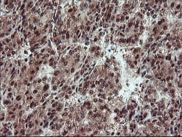 TRAIP / TRIP Antibody (aa67-313, clone OTI2D4, Carrier-free)