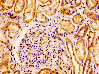 Polyclonal Rabbit anti-Human FLOT1 / Flotillin 1 Antibody (IHC, WB)