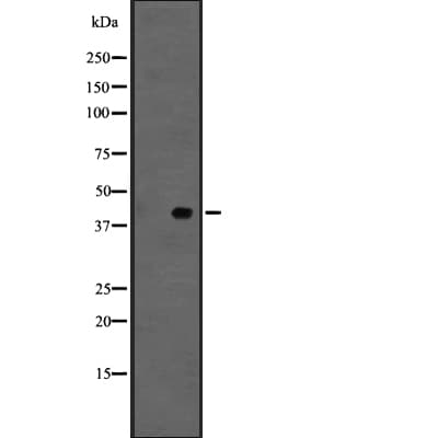 GPER1 / GPR30 Antibody