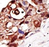 PIGK Antibody (aa37-68)