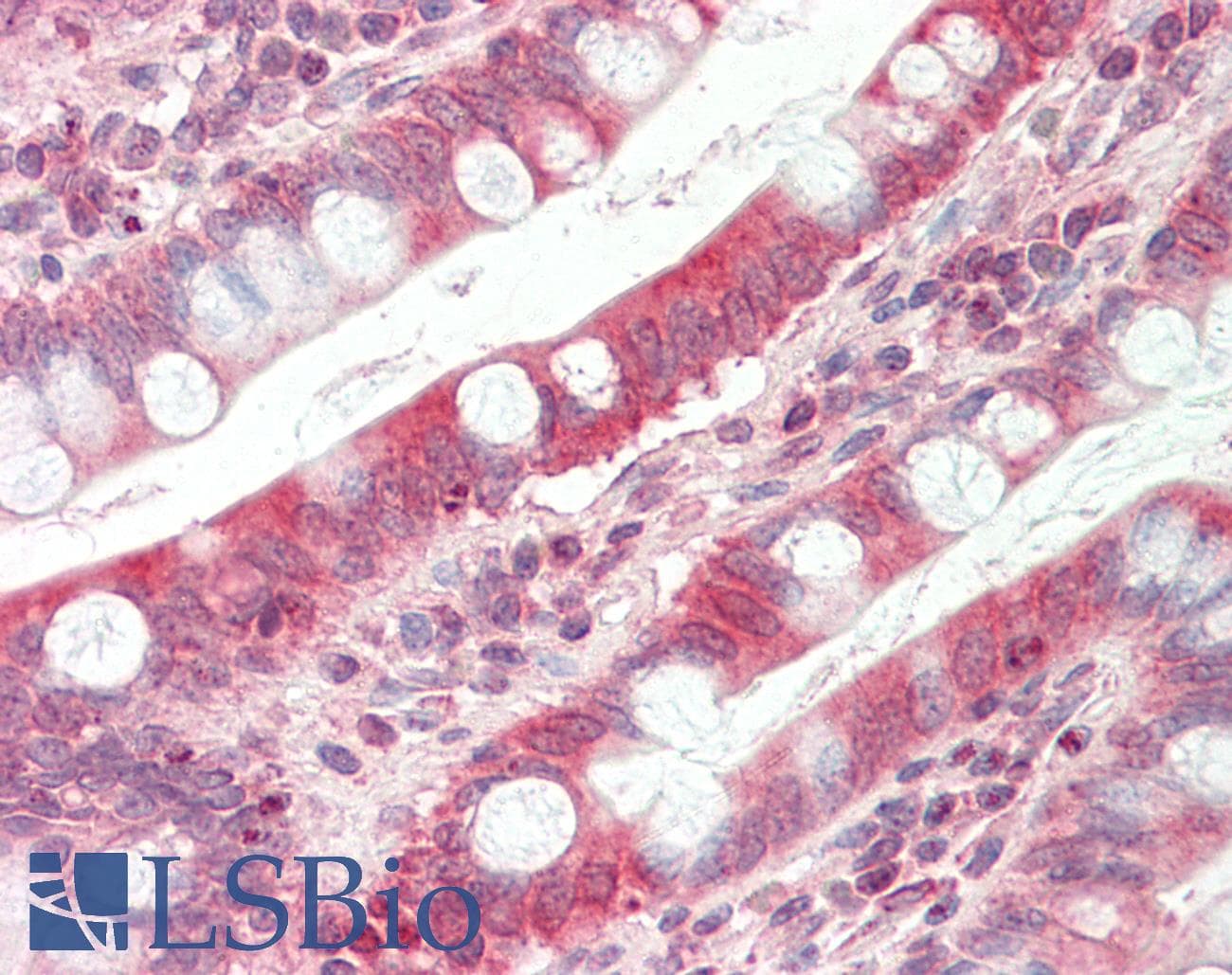 TAPBP / Tapasin Antibody (aa307-356)
