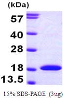 Human MAP1LC3A / LC3A Protein (Recombinant His)