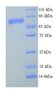 Human RSV F0 Protein (Recombinant 6His, N-terminus)