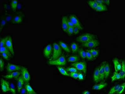 Polyclonal Rabbit anti-Human GPC4 / Glypican 4 Antibody (IHC, WB)