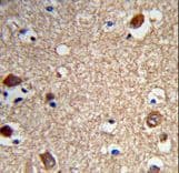 ACTR5 / ARP5 Antibody (aa539-568)