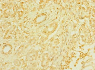 T1R3 / TAS1R3 Antibody