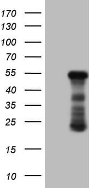 Monoclonal Mouse anti-Human RB1 / Retinoblastoma / RB Antibody (clone OTI1C3, aa309-590, IHC, WB)