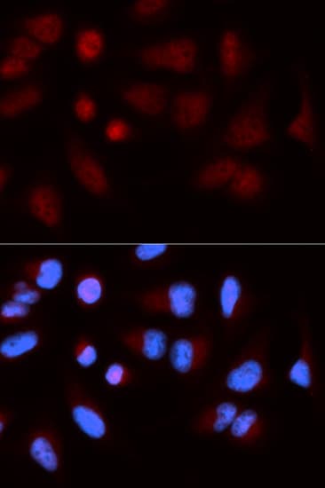 Polyclonal Rabbit anti-Human SH2B1 Antibody (IHC, IF, WB)