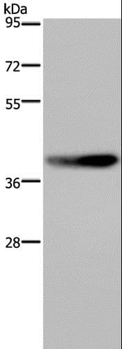 DUSP4 / MKP2 Antibody