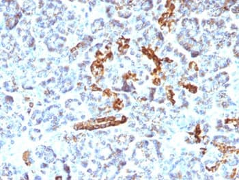 NCAM / CD56 Antibody (clone NCAM1/795)