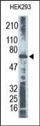 RELA / NFKB p65 Antibody