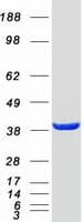 Human GMPPB Protein (Recombinant Myc-DDK (Flag))