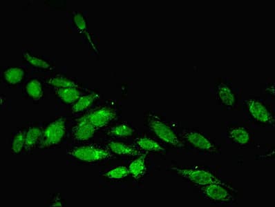 Polyclonal Rabbit anti-Human PARP3 Antibody (aa294-533, IHC, WB)