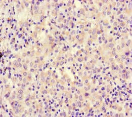 Polyclonal Rabbit anti-Human RCOR1 / COREST Antibody (IHC)